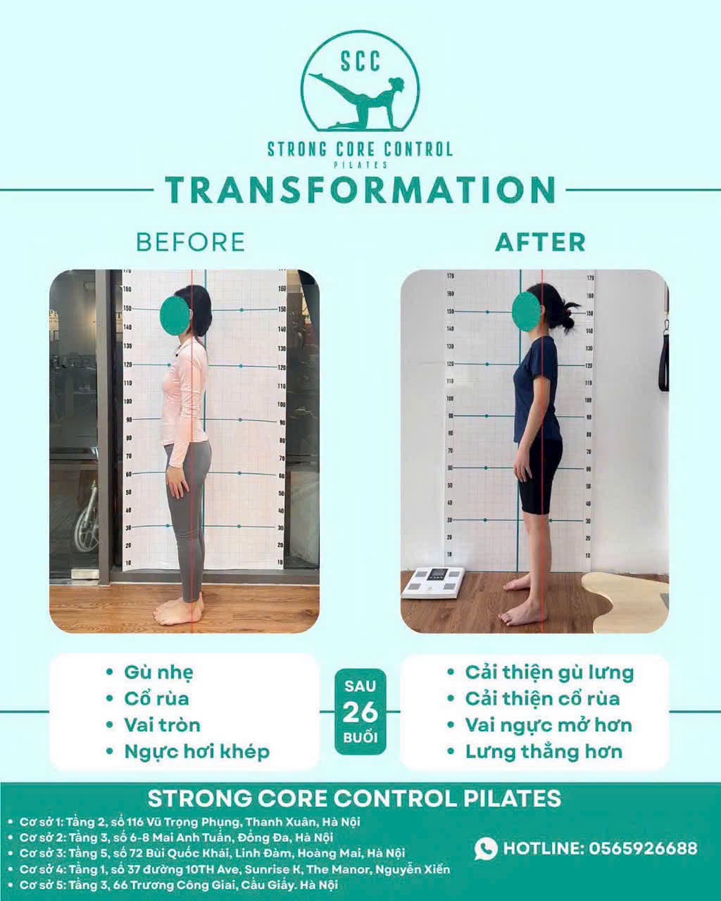 Kết quả cải thiện tư thế sau 26 buổi tại SCC Pilates